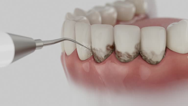 Trusted Dental Crowns And Bridges service in Bridgeport, WV - Dentist Open Now